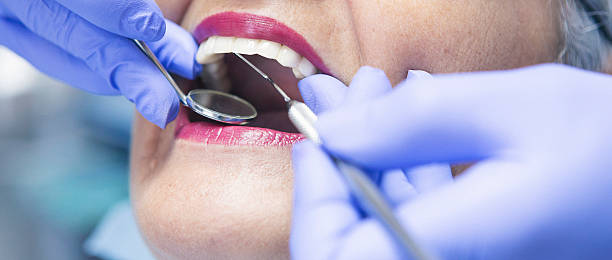 Best Emergency Broken Tooth Repair in Burns, OR